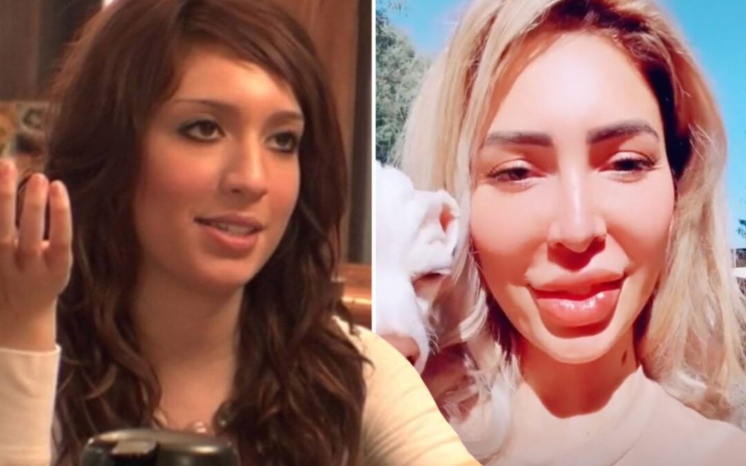 Teen Mom Farrah Abraham ripped for looking ‘deformed & puffy’ as fans beg her to stop getting lip fillers