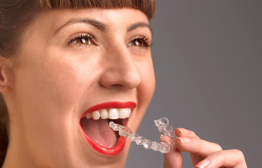Taking Care of Your New Smile After Invisalign Treatment