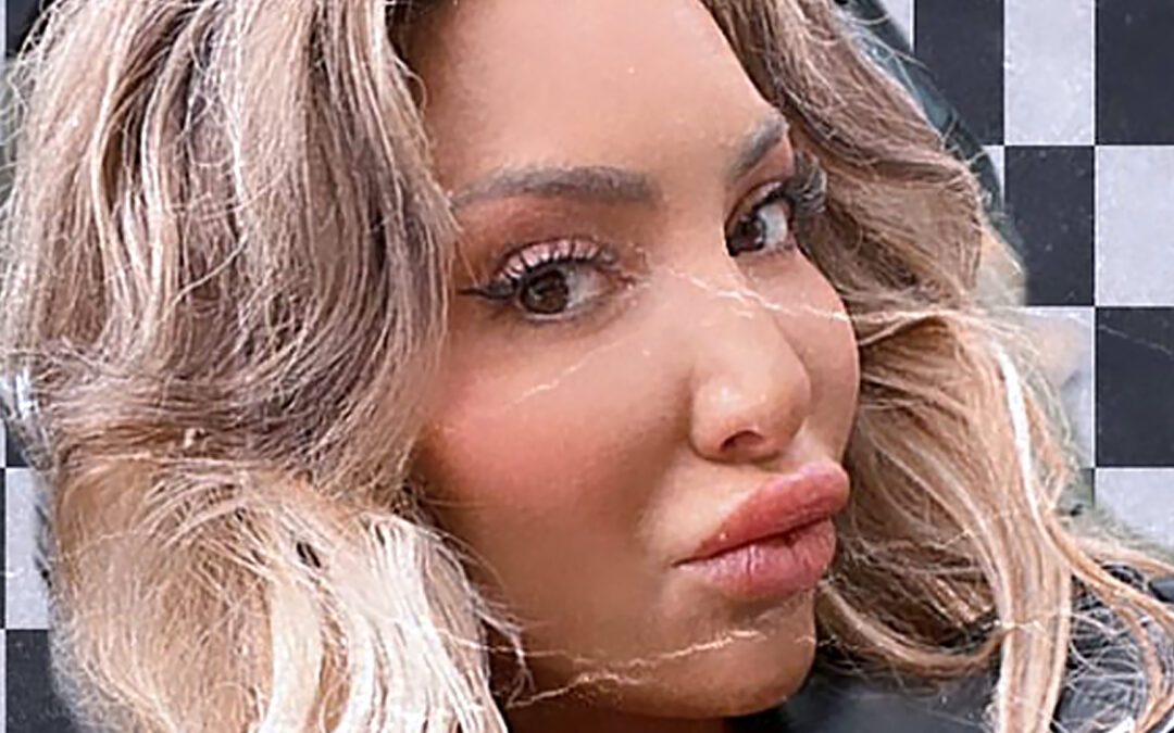 Teen Mom Farrah Abraham shows off massive lips after her face ‘appears to DROOP’ in new photos