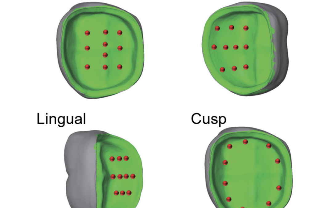 New study finds 3D printing to be more accurate than milling in the creation of dental crowns 