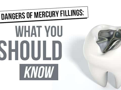 The Dangers of Mercury Teeth Fillings | Herbie J Pilato