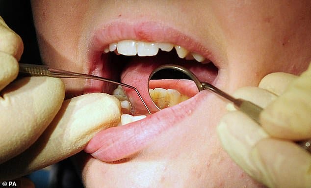 Report finds patients resorting to DIY tooth extractions due to inability to afford dentist