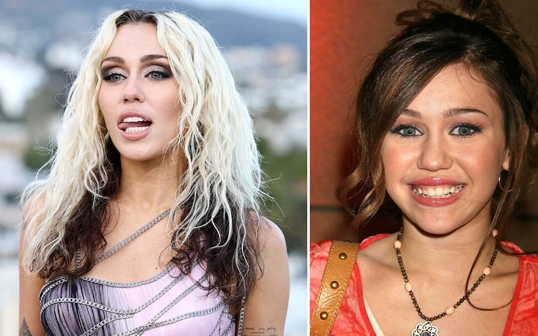 Miley Cyrus smile makeover: what has she done to her teeth?