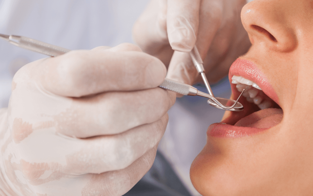 After tooth extractions, cannabidiol emerges as an opti...