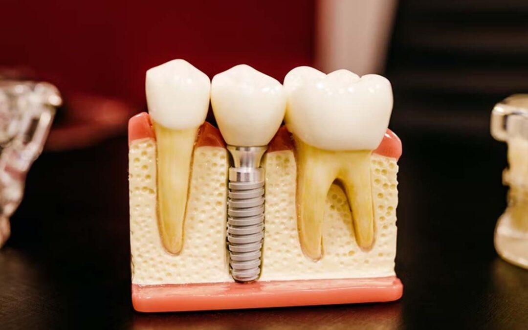 ROOT CANAL APPRECIATION DAY - May 12, 2027